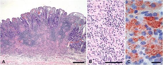 https://cdn.ncbi.nlm.nih.gov/pmc/blobs/745a/4404677/a8dbb48ad166/12917_2015_381_Fig6_HTML.jpg