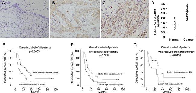 https://cdn.ncbi.nlm.nih.gov/pmc/blobs/745a/5589647/efc17bcb08e3/oncotarget-08-55135-g001.jpg