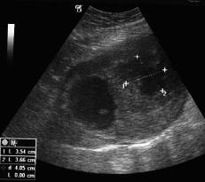 https://cdn.ncbi.nlm.nih.gov/pmc/blobs/745c/2993706/61110554d58f/1477-7819-8-95-2.jpg