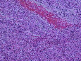 https://cdn.ncbi.nlm.nih.gov/pmc/blobs/745c/2993706/70aa9ebbd884/1477-7819-8-95-7.jpg