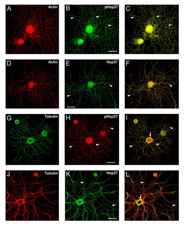 https://cdn.ncbi.nlm.nih.gov/pmc/blobs/746a/1087488/a6bcee28c6e6/1471-2202-6-24-4.jpg