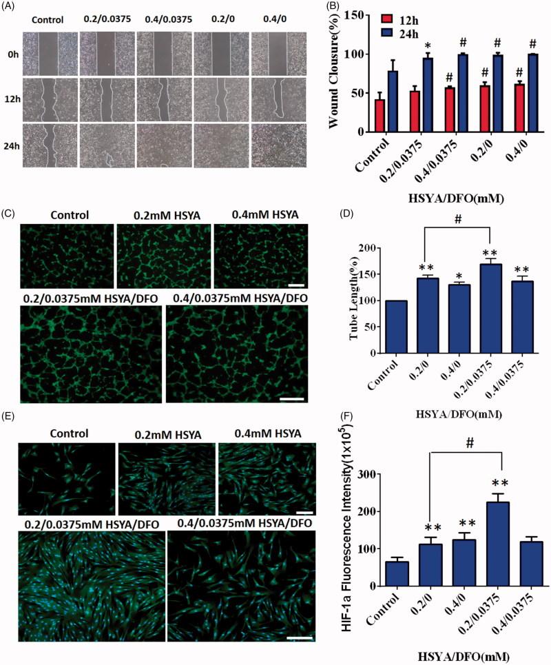 https://cdn.ncbi.nlm.nih.gov/pmc/blobs/746b/6201774/43a35b3812af/IDRD_A_1513608_F0001_C.jpg