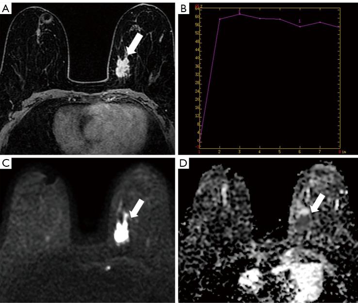 https://cdn.ncbi.nlm.nih.gov/pmc/blobs/746e/11652052/688df8fc5959/qims-14-12-8387-f2.jpg