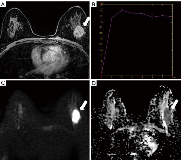 https://cdn.ncbi.nlm.nih.gov/pmc/blobs/746e/11652052/bd2338995131/qims-14-12-8387-f3.jpg