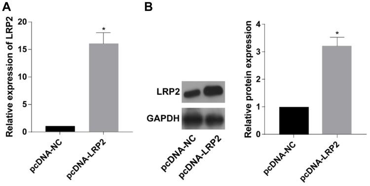 https://cdn.ncbi.nlm.nih.gov/pmc/blobs/7471/6954091/8e939781a9e9/OTT-13-45-g0004.jpg