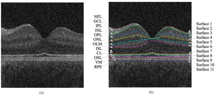 https://cdn.ncbi.nlm.nih.gov/pmc/blobs/7472/10054815/1a341d954429/sensors-23-03144-g003.jpg