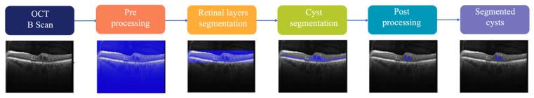 https://cdn.ncbi.nlm.nih.gov/pmc/blobs/7472/10054815/d6942809d331/sensors-23-03144-g004.jpg