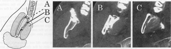 https://cdn.ncbi.nlm.nih.gov/pmc/blobs/747f/2149029/5b383e383289/anesthprog00224-0020-b.jpg