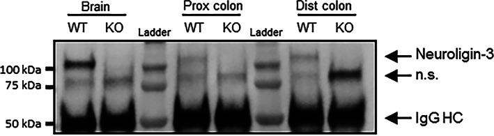 https://cdn.ncbi.nlm.nih.gov/pmc/blobs/747f/7317711/94235a533c51/AUR-13-691-g003.jpg
