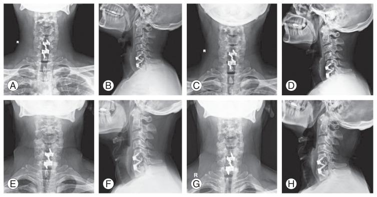https://cdn.ncbi.nlm.nih.gov/pmc/blobs/7481/9441440/12f51084706b/asj-2021-0209f2.jpg