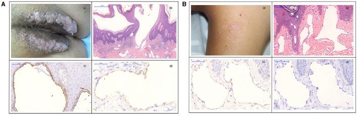https://cdn.ncbi.nlm.nih.gov/pmc/blobs/7486/8533675/75c9cce878af/fmed-08-738815-g0002.jpg