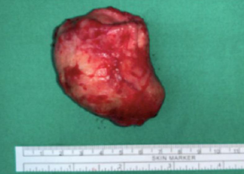 https://cdn.ncbi.nlm.nih.gov/pmc/blobs/7488/7852652/52d44d4af8e7/WJCC-9-838-g004.jpg
