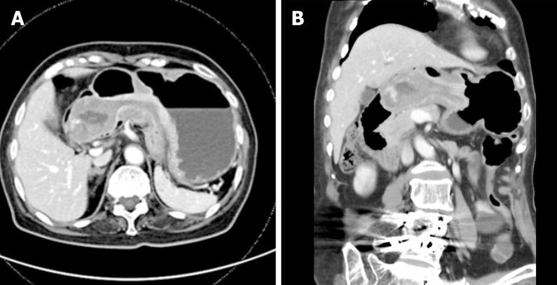 https://cdn.ncbi.nlm.nih.gov/pmc/blobs/7488/7852652/ec2e6cb82d96/WJCC-9-838-g003.jpg
