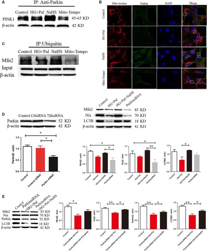 https://cdn.ncbi.nlm.nih.gov/pmc/blobs/7493/5706497/6cfc17461840/JCMM-21-3190-g006.jpg