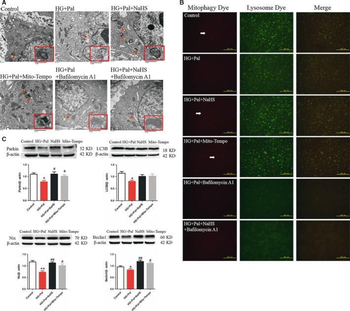 https://cdn.ncbi.nlm.nih.gov/pmc/blobs/7493/5706497/6f813084fb12/JCMM-21-3190-g005.jpg