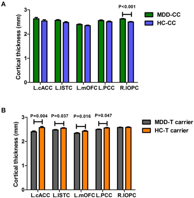 https://cdn.ncbi.nlm.nih.gov/pmc/blobs/749b/7751613/90fd20fb0a37/fpsyt-11-531959-g0001.jpg