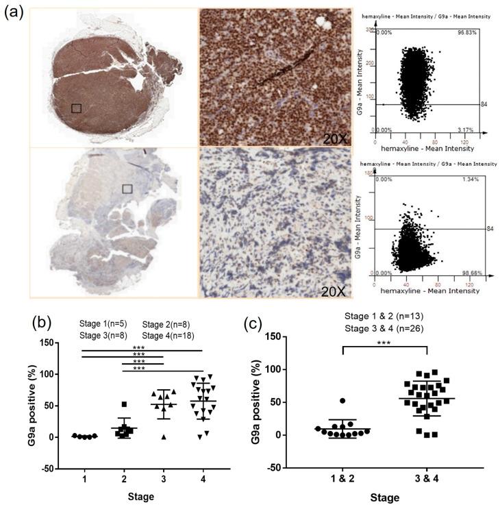 https://cdn.ncbi.nlm.nih.gov/pmc/blobs/749c/10452841/bfc3c9c7c783/cancers-15-04150-g005.jpg