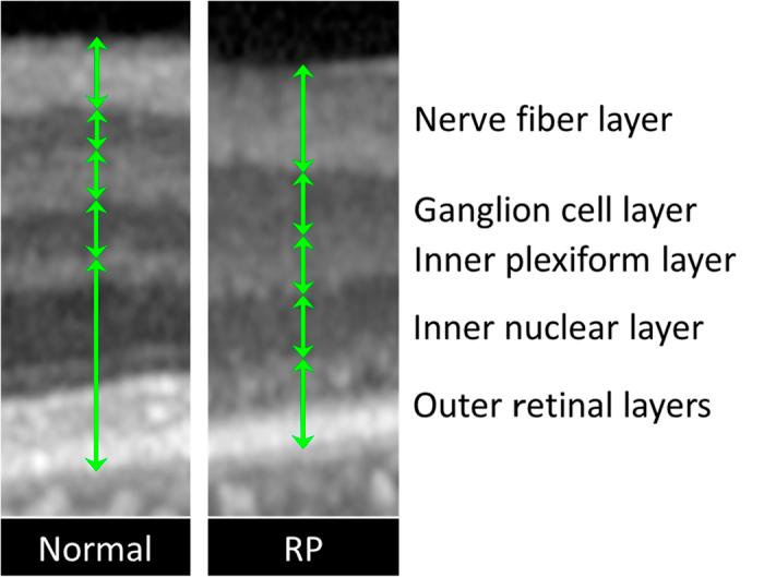 https://cdn.ncbi.nlm.nih.gov/pmc/blobs/749c/5031997/18d26f837d73/srep33921-f4.jpg