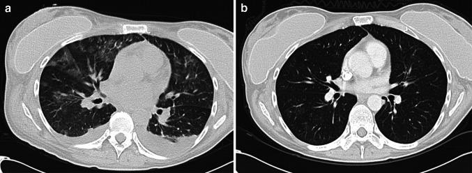 https://cdn.ncbi.nlm.nih.gov/pmc/blobs/749f/11028570/b6e88cf8d909/262_2017_2034_Fig4_HTML.jpg