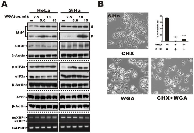https://cdn.ncbi.nlm.nih.gov/pmc/blobs/74a1/5710917/cd4a8090de44/oncotarget-08-91209-g005.jpg