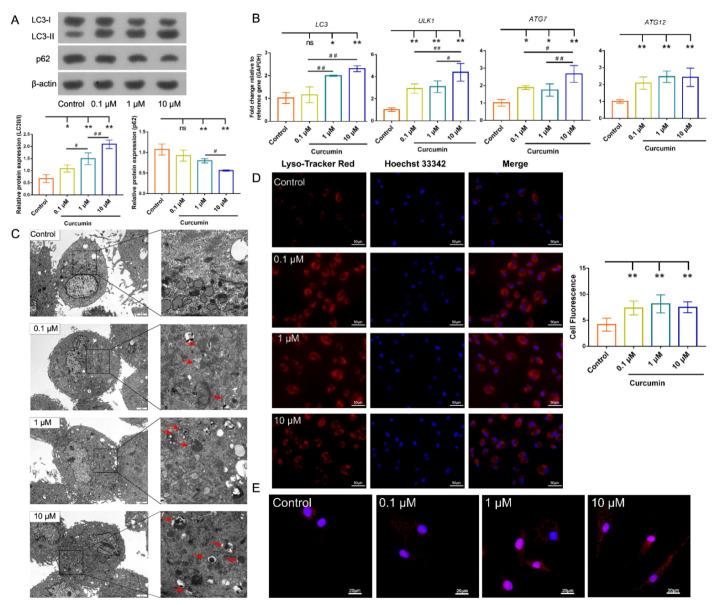 https://cdn.ncbi.nlm.nih.gov/pmc/blobs/74ac/8583405/708b24c7b4ba/ijms-22-11356-g004.jpg
