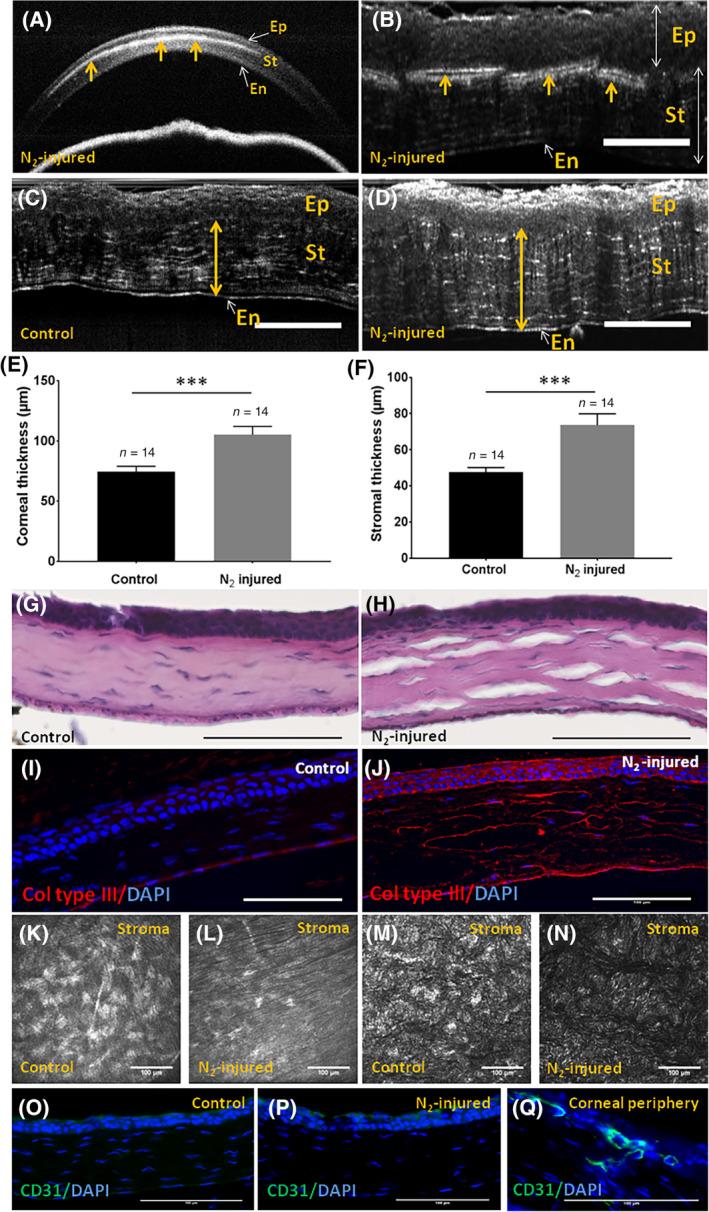 https://cdn.ncbi.nlm.nih.gov/pmc/blobs/74ad/7381812/6a9943e2350a/SCT3-9-917-g002.jpg