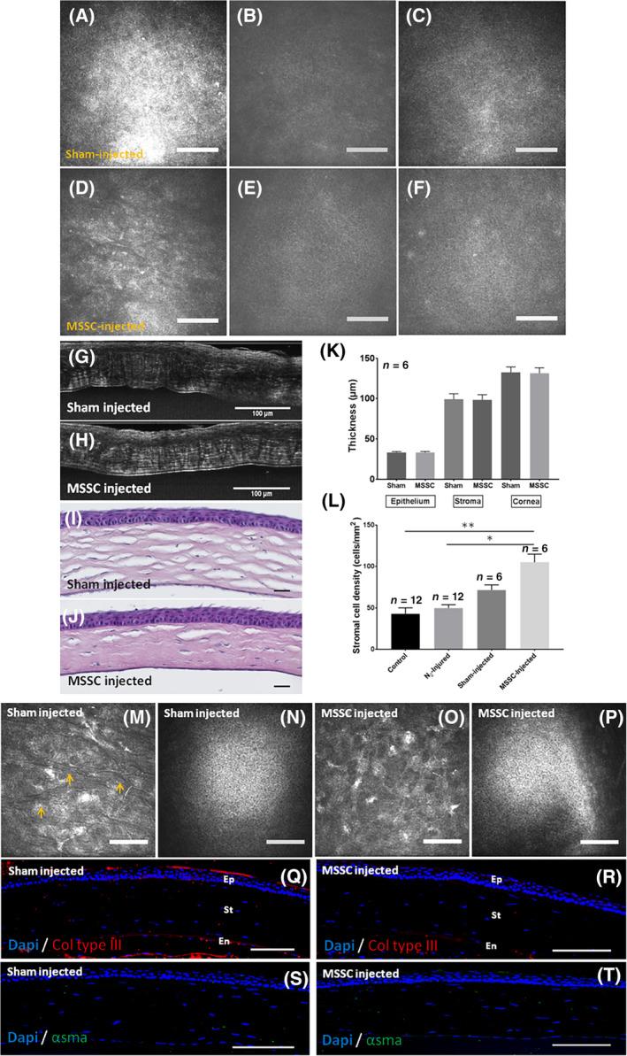 https://cdn.ncbi.nlm.nih.gov/pmc/blobs/74ad/7381812/e4c13a07bc69/SCT3-9-917-g006.jpg