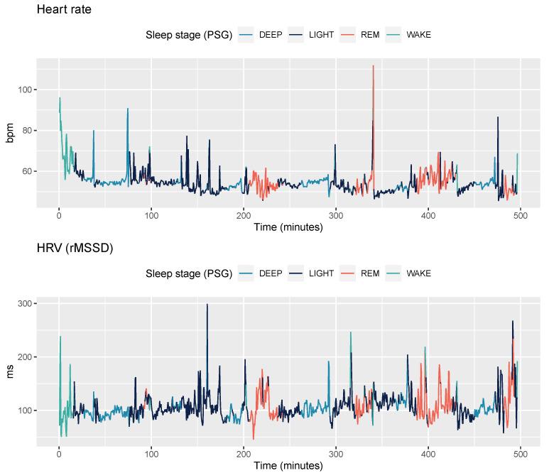 https://cdn.ncbi.nlm.nih.gov/pmc/blobs/74ae/8271886/f16bbd5765fa/sensors-21-04302-g003.jpg