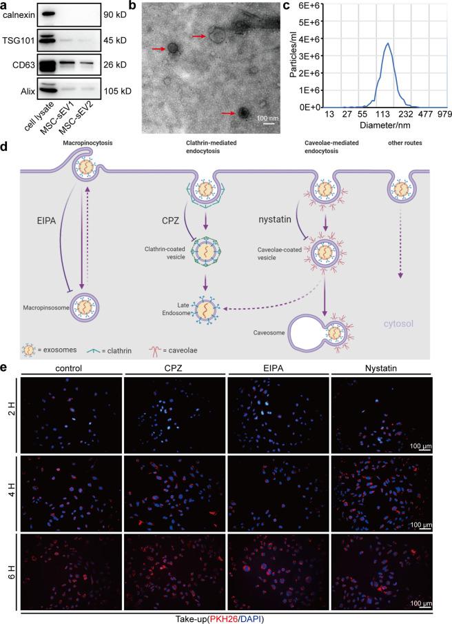 https://cdn.ncbi.nlm.nih.gov/pmc/blobs/74af/8531331/4c3abf066f1d/41392_2021_765_Fig1_HTML.jpg