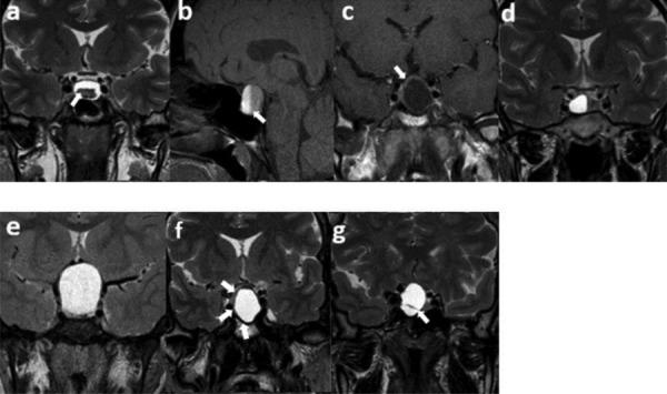 https://cdn.ncbi.nlm.nih.gov/pmc/blobs/74b2/10836174/afc1473b570b/jbsr-108-1-3470-g1.jpg