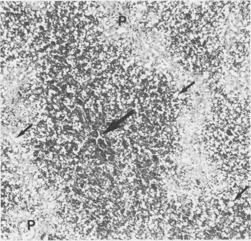 https://cdn.ncbi.nlm.nih.gov/pmc/blobs/74c2/1306876/8c65c5b54b12/westjmed00156-0066-b.jpg