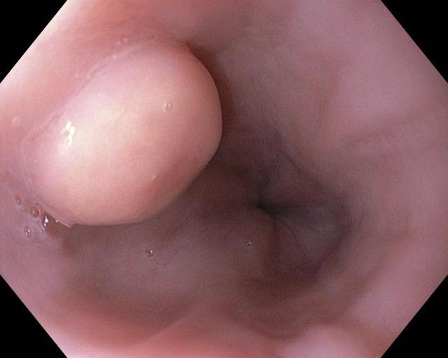 https://cdn.ncbi.nlm.nih.gov/pmc/blobs/74c4/5065346/d58cd2aa9285/cureus-0008-000000000782-i01.jpg