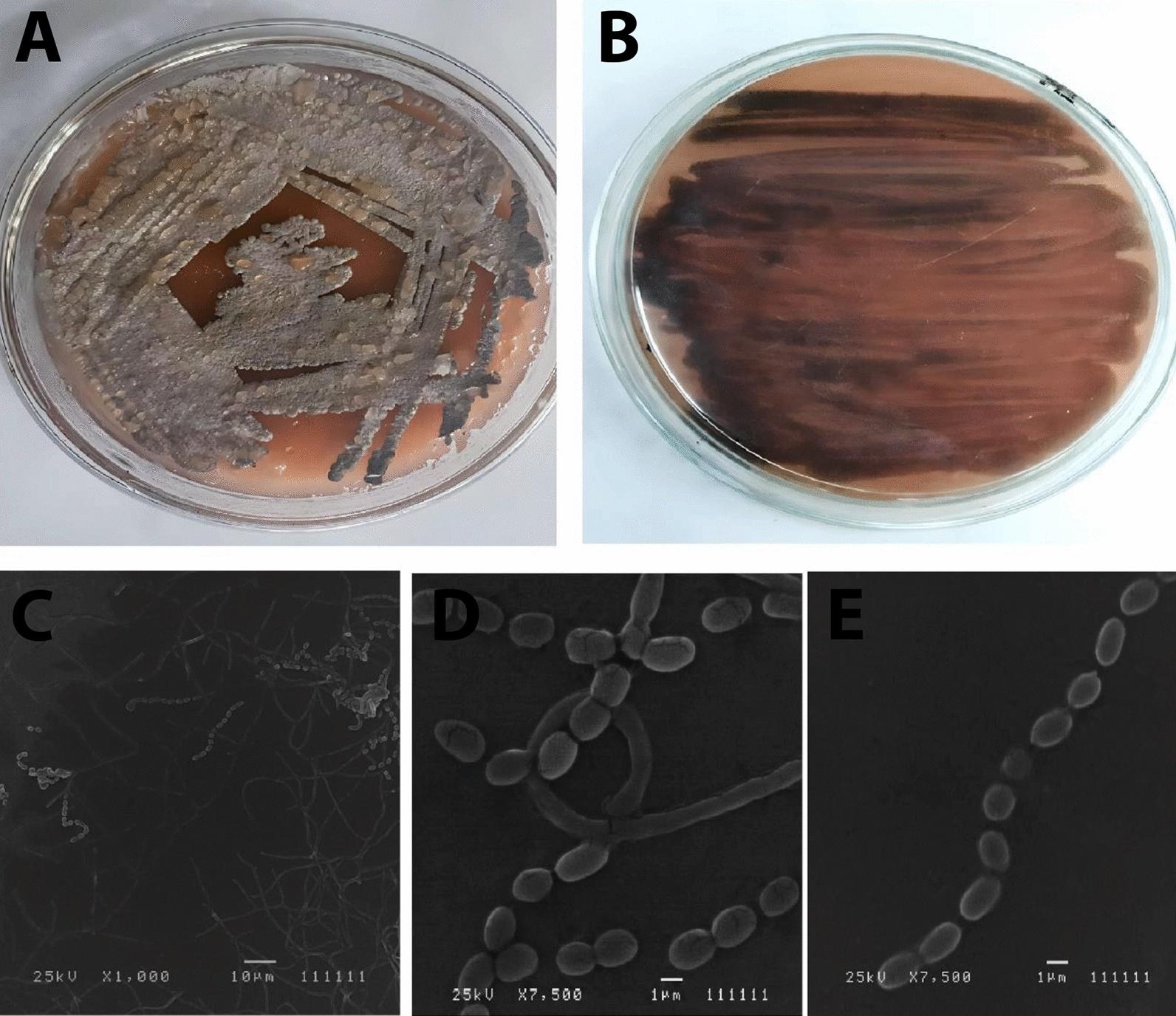 https://cdn.ncbi.nlm.nih.gov/pmc/blobs/74c6/10792909/f99149f0ae51/12934_2023_2276_Fig2_HTML.jpg