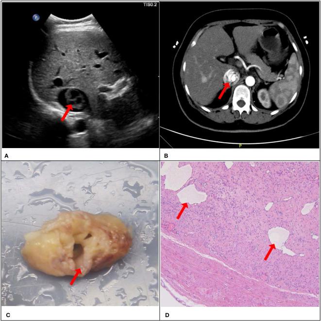 https://cdn.ncbi.nlm.nih.gov/pmc/blobs/74cf/10364609/650b305a5a86/fonc-13-1203591-g004.jpg