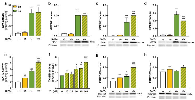 https://cdn.ncbi.nlm.nih.gov/pmc/blobs/74cf/11505002/0ba00f4742ae/antioxidants-13-01211-g002.jpg