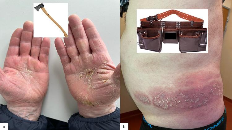 https://cdn.ncbi.nlm.nih.gov/pmc/blobs/74e8/11705962/79a24d00b154/PTT-15-1-g0002.jpg