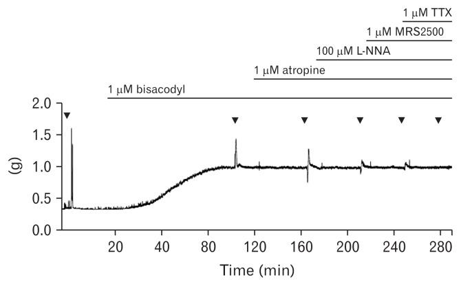 https://cdn.ncbi.nlm.nih.gov/pmc/blobs/74f9/5885731/ea0d59cb6b9b/jnm-24-317f1.jpg