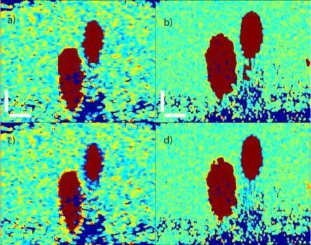 https://cdn.ncbi.nlm.nih.gov/pmc/blobs/7500/3087589/6dd398ab1033/boe-2-5-1328-g007.jpg