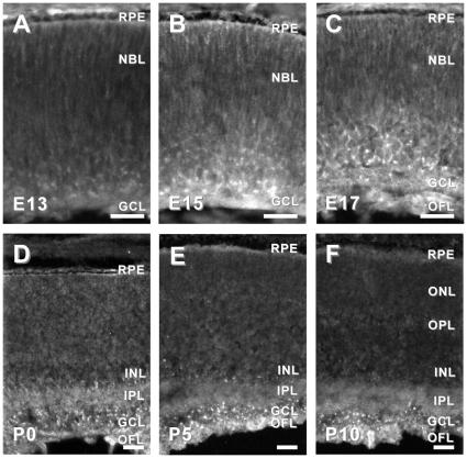 https://cdn.ncbi.nlm.nih.gov/pmc/blobs/7503/2932711/e02e86521e26/pone.0012525.g002.jpg