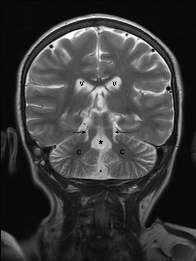 https://cdn.ncbi.nlm.nih.gov/pmc/blobs/7508/11293500/811c138bf628/gr4.jpg
