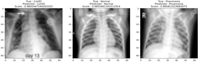https://cdn.ncbi.nlm.nih.gov/pmc/blobs/7509/8639408/51c74ce37d1c/354_2021_143_Fig11_HTML.jpg