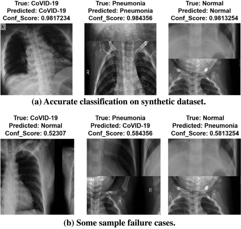 https://cdn.ncbi.nlm.nih.gov/pmc/blobs/7509/8639408/f32541e6f908/354_2021_143_Fig16_HTML.jpg