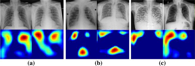 https://cdn.ncbi.nlm.nih.gov/pmc/blobs/7509/8639408/f65fd9ca55a7/354_2021_143_Fig15_HTML.jpg