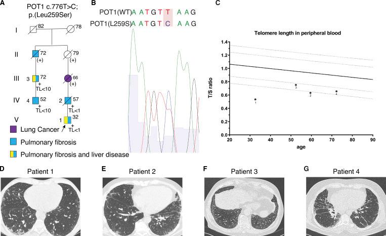 https://cdn.ncbi.nlm.nih.gov/pmc/blobs/750b/9014792/8425b1459faa/JEM_20211681_Fig1.jpg