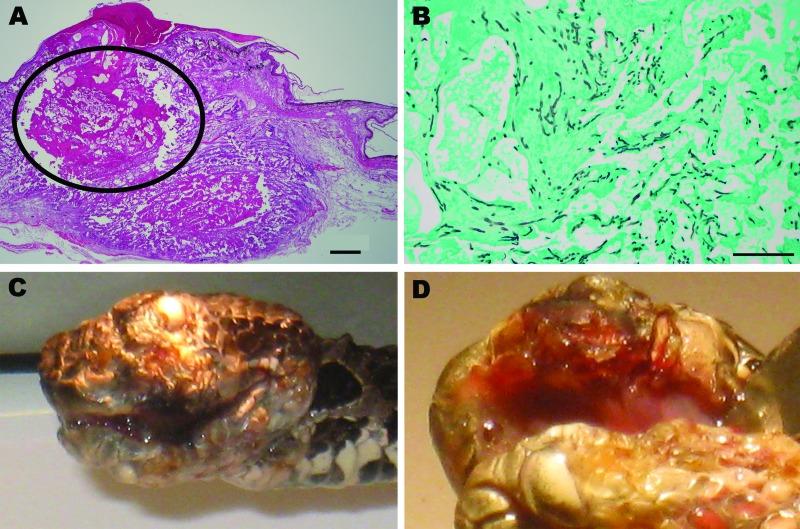 https://cdn.ncbi.nlm.nih.gov/pmc/blobs/750f/3311193/7b112055c87c/11-0240-F.jpg