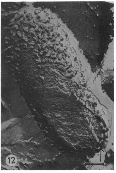https://cdn.ncbi.nlm.nih.gov/pmc/blobs/751f/429267/6f4e6009948c/aac00325-0109-a.jpg