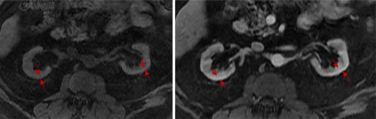 https://cdn.ncbi.nlm.nih.gov/pmc/blobs/7525/11223291/9e893d782ab5/12967_2024_5333_Fig2_HTML.jpg