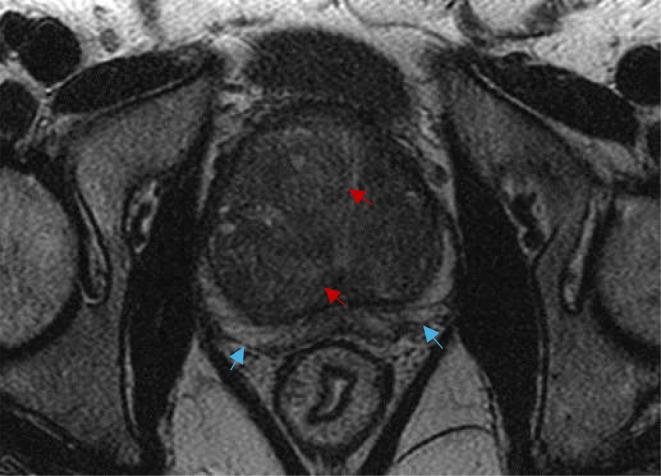 https://cdn.ncbi.nlm.nih.gov/pmc/blobs/7525/11223291/e840601f2f4e/12967_2024_5333_Fig7_HTML.jpg