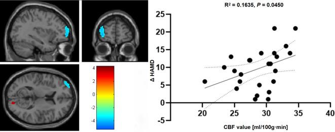 https://cdn.ncbi.nlm.nih.gov/pmc/blobs/7525/12315559/0f1349b746eb/fpsyt-16-1521565-g003.jpg