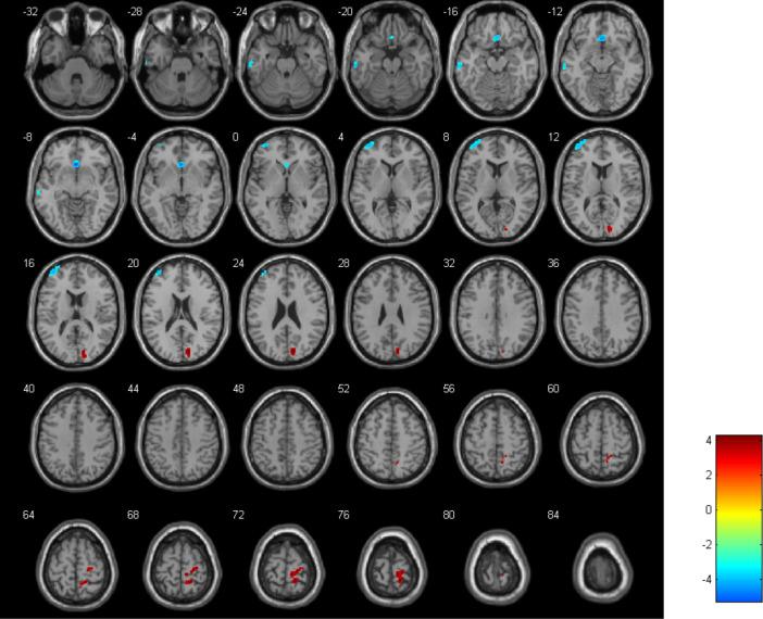 https://cdn.ncbi.nlm.nih.gov/pmc/blobs/7525/12315559/715ed60a2066/fpsyt-16-1521565-g001.jpg